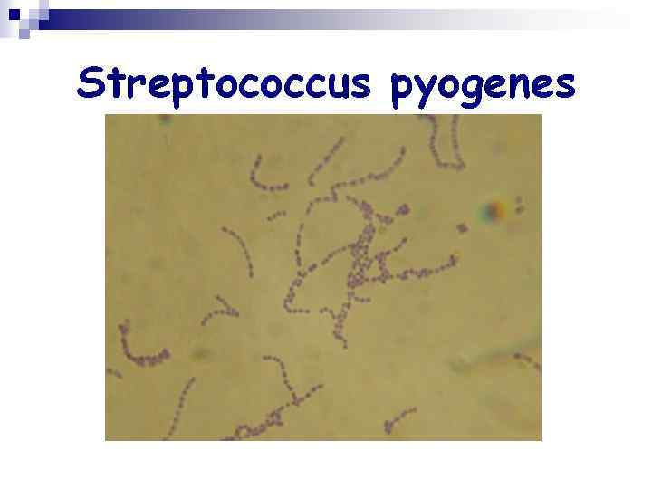 Streptococcus pyogenes 