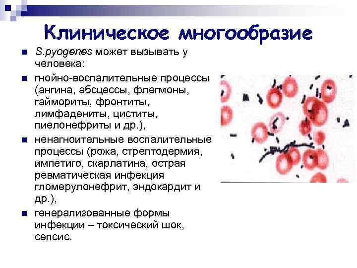 Клиническое многообразие n n S. pyogenes может вызывать у человека: гнойно-воспалительные процессы (ангина, абсцессы,