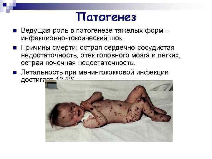 Патогенез n n n Ведущая роль в патогенезе тяжелых форм – инфекционно-токсический шок. Причины