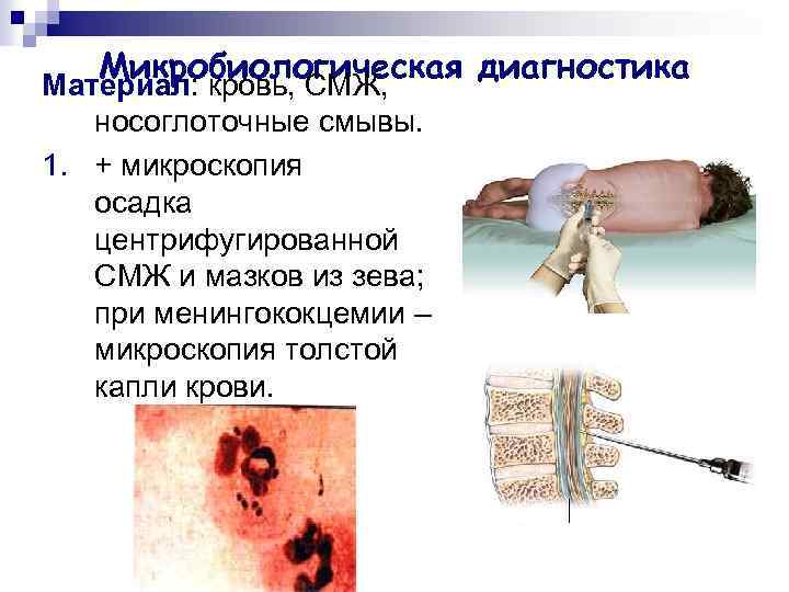 Микробиологическая диагностика Материал: кровь, СМЖ, носоглоточные смывы. 1. + микроскопия осадка центрифугированной СМЖ и