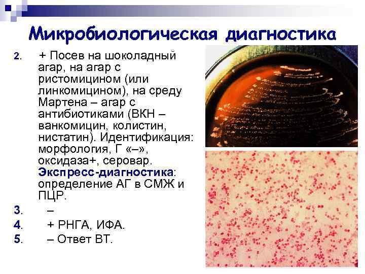 Микробиологическая диагностика 2. 3. 4. 5. + Посев на шоколадный агар, на агар с