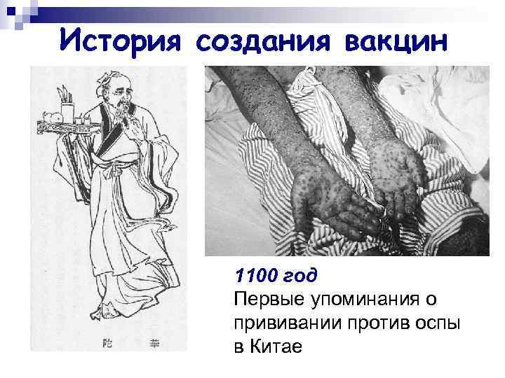 История создания вакцин 1100 год Первые упоминания о прививании против оспы в Китае 