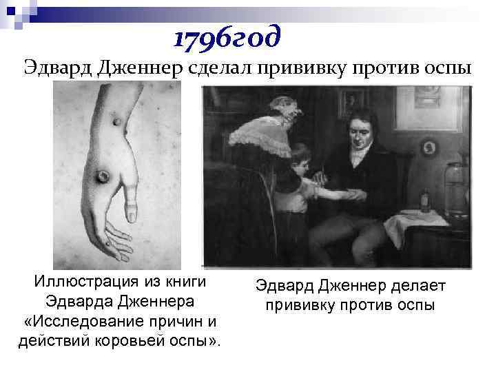 1796 год Эдвард Дженнер сделал прививку против оспы Иллюстрация из книги Эдварда Дженнера «Исследование