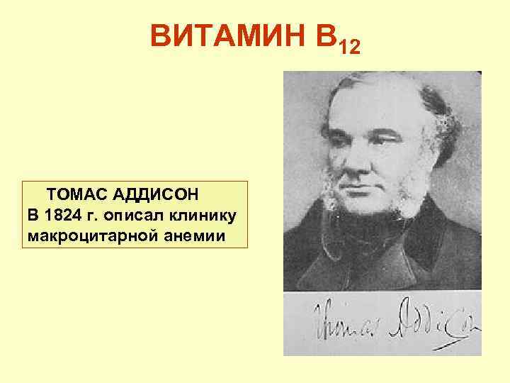 ВИТАМИН В 12 ТОМАС АДДИСОН В 1824 г. описал клинику макроцитарной анемии 