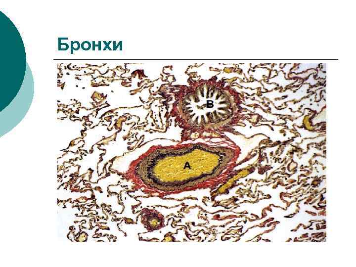 Бронхи 
