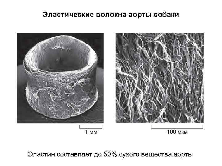 Эластические волокна аорты собаки Эластин составляет до 50% сухого вещества аорты 