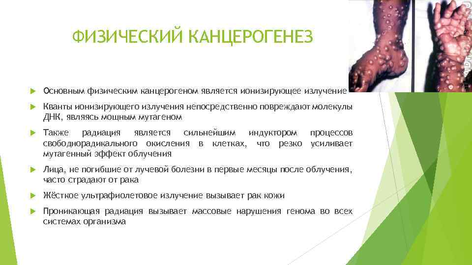 ФИЗИЧЕСКИЙ КАНЦЕРОГЕНЕЗ Основным физическим канцерогеном является ионизирующее излучение Кванты ионизирующего излучения непосредственно повреждают молекулы
