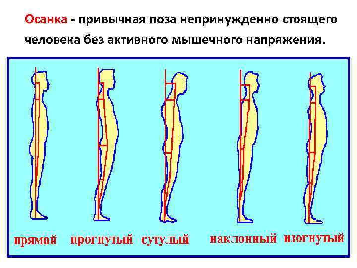 Привычное положение тела стоящего человека. Нормальная осанка. Нормальная осанка человека. Привычная поза непринужденно стоящего человека. Выпрямленная осанка характеризуется.