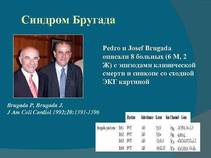 Синдром Бругада Pedro и Josef Brugada описали 8 больных (6 М, 2 Ж) с
