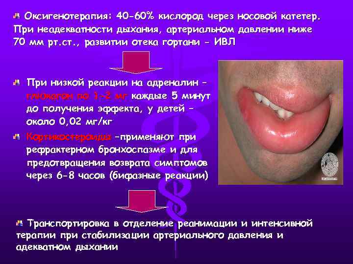 Оксигенотерапия: 40 -60% кислород через носовой катетер. При неадекватности дыхания, артериальном давлении ниже 70