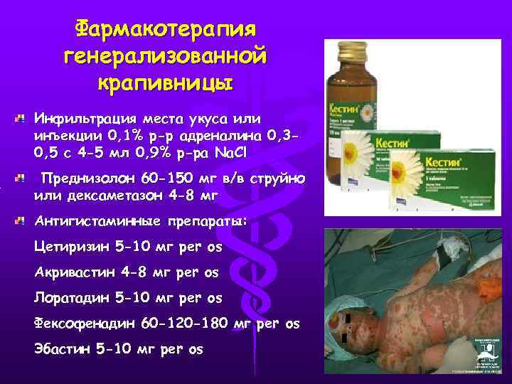 Фармакотерапия генерализованной крапивницы Инфильтрация места укуса или инъекции 0, 1% р-р адреналина 0, 30,