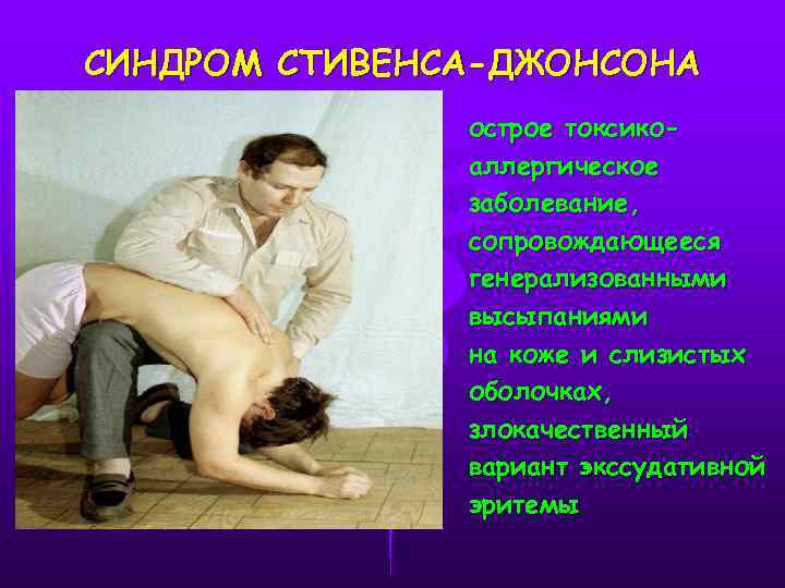 СИНДРОМ СТИВЕНСА-ДЖОНСОНА острое токсикоаллергическое заболевание, сопровождающееся генерализованными высыпаниями на коже и слизистых оболочках, злокачественный