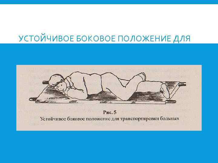 УСТОЙЧИВОЕ БОКОВОЕ ПОЛОЖЕНИЕ ДЛЯ ТРАНСПОРТИРОВКИ БОЛЬНЫХ 