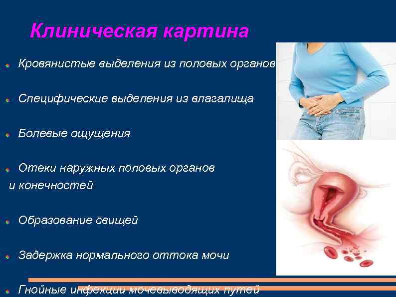 Клиническая картина Кровянистые выделения из половых органов Специфические выделения из влагалища Болевые ощущения Отеки