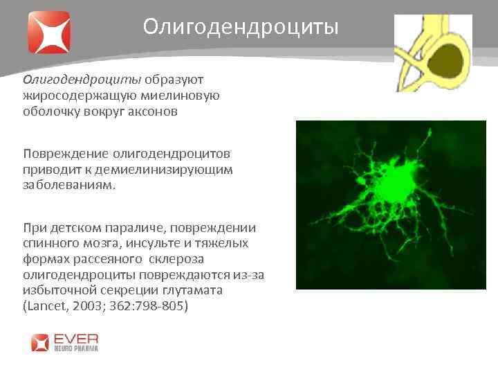 Олигодендроциты образуют жиросодержащую миелиновую оболочку вокруг аксонов Повреждение олигодендроцитов приводит к демиелинизирующим заболеваниям. При