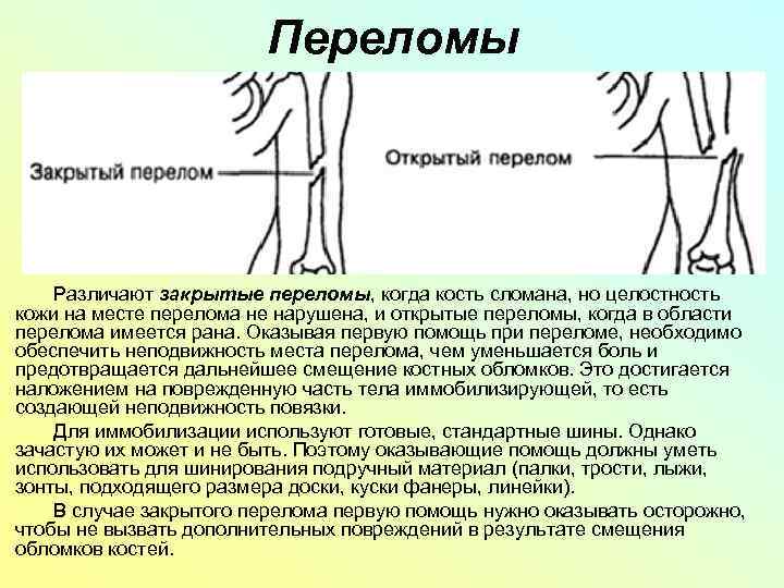 Перелом луча в типичном месте карта вызова скорой