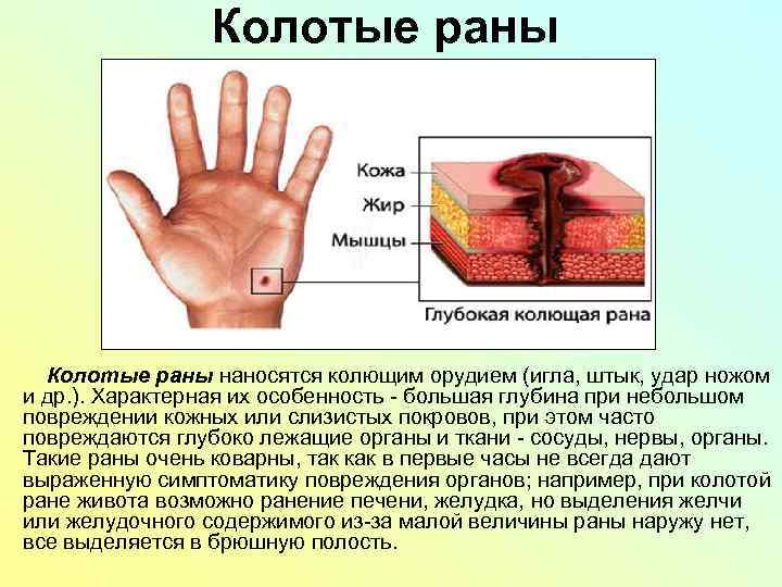 Колото резаная рана фото