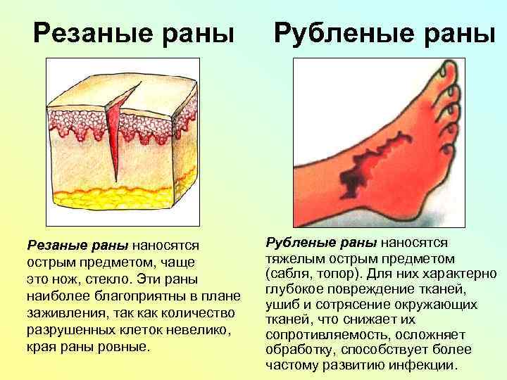 Резаная рана кисти карта вызова скорой