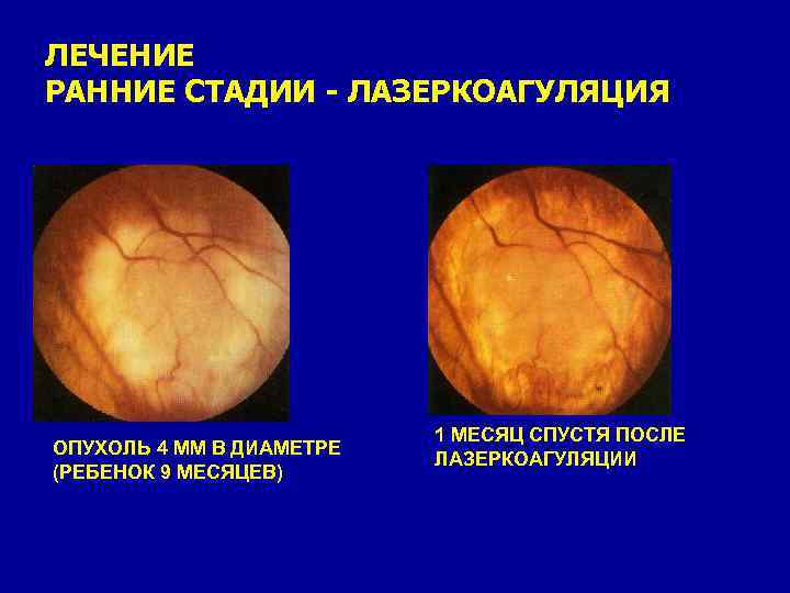 Офтальмология учебник что такое глаукома thumbnail
