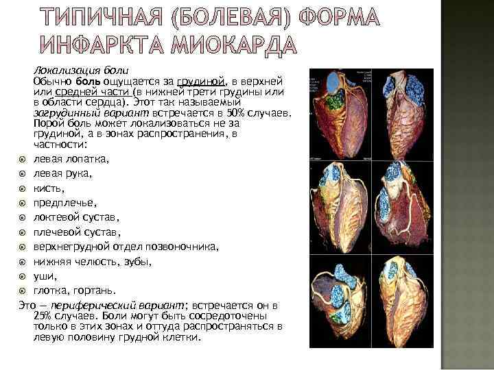 Локализация боли Обычно боль ощущается за грудиной, в верхней или средней части (в нижней