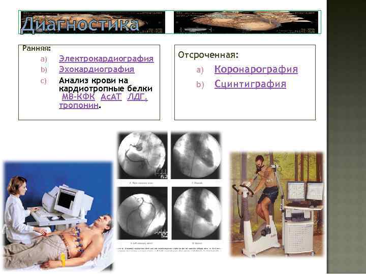 Диагностика Ранняя: a) b) c) Электрокардиография Эхокардиография Анализ крови на кардиотропные белки (MB-КФК, Ас.