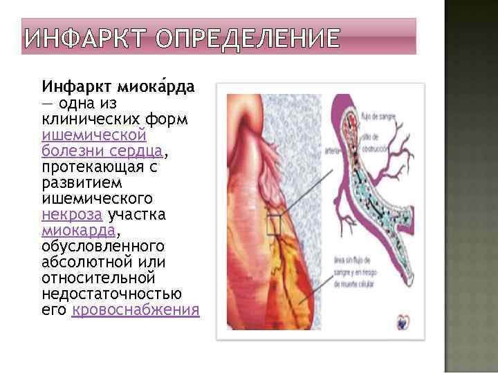 ИНФАРКТ ОПРЕДЕЛЕНИЕ Инфаркт миока рда — одна из клинических форм ишемической болезни сердца, протекающая