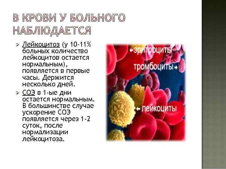 Ø Ø Лейкоцитоз (у 10 -11% больных количество лейкоцитов остается нормальным), появляется в первые