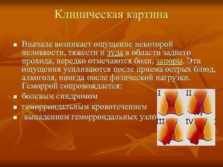 Клиническая картина n n Вначале возникает ощущение некоторой неловкости, тяжести и зуда в области