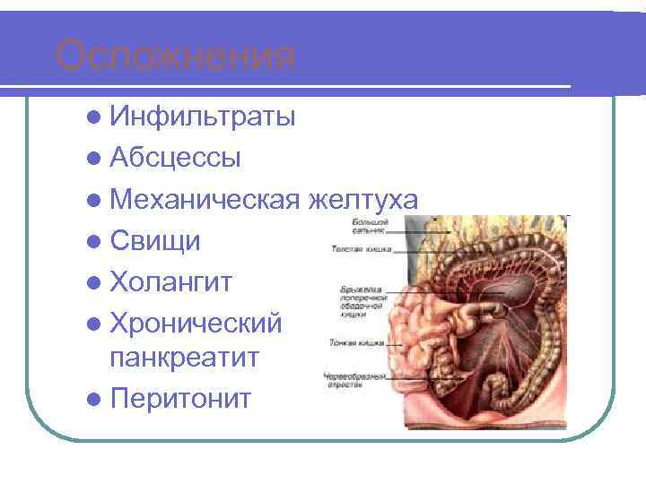 Осложнения l Инфильтраты l Абсцессы l Механическая желтуха l Свищи l Холангит l Хронический