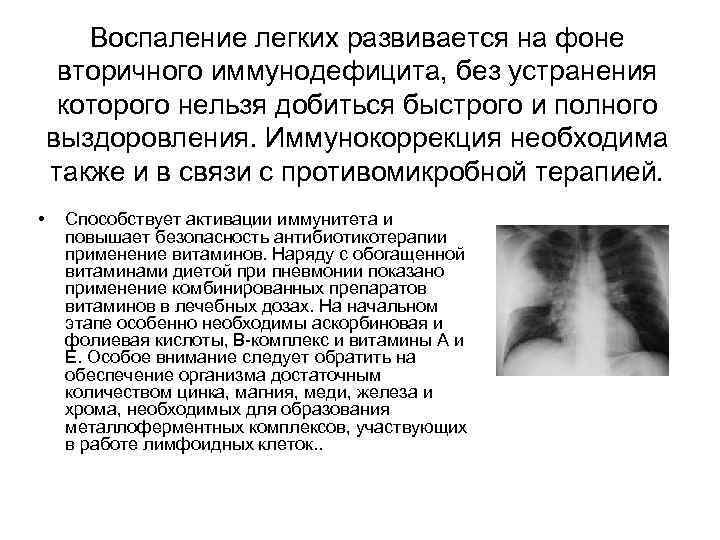 Воспаление легких развивается на фоне вторичного иммунодефицита, без устранения которого нельзя добиться быстрого и