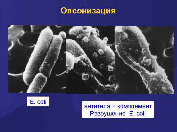 Опсонизация E. coli антитела + комплемент Разрушение E. coli 