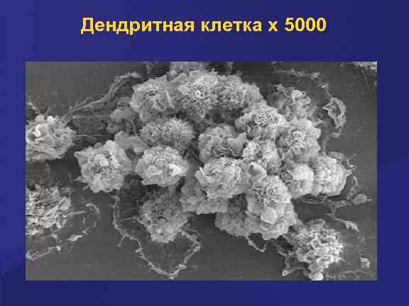 Дендритная клетка х 5000 