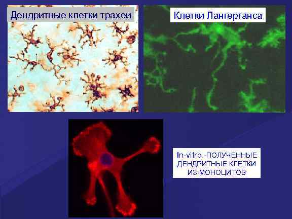 Дендритные клетки трахеи Клетки Лангерганса In-vitro -ПОЛУЧЕННЫЕ ДЕНДРИТНЫЕ КЛЕТКИ ИЗ МОНОЦИТОВ 