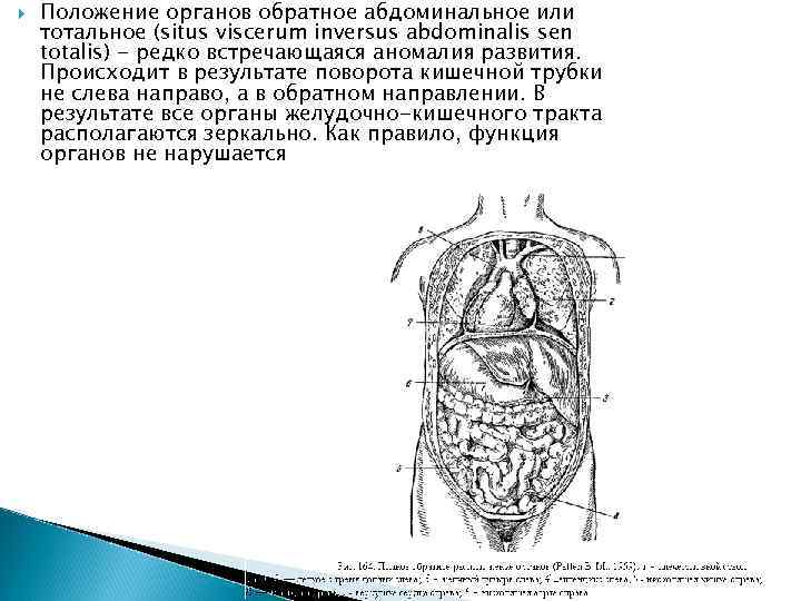  Положение органов обратное абдоминальное или тотальное (situs viscerum inversus abdominalis sen totalis) -