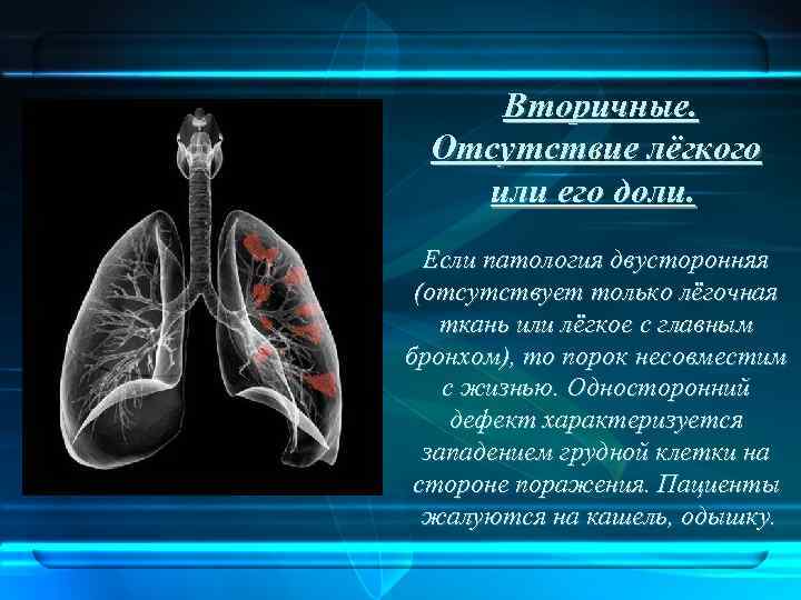 Вторичные. Отсутствие лёгкого или его доли. Если патология двусторонняя (отсутствует только лёгочная ткань или