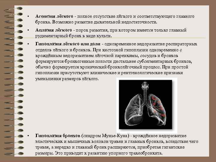  • Агенезия лёгкого - полное отсутствие лёгкого и соответствующего главного бронха. Возможно развитие