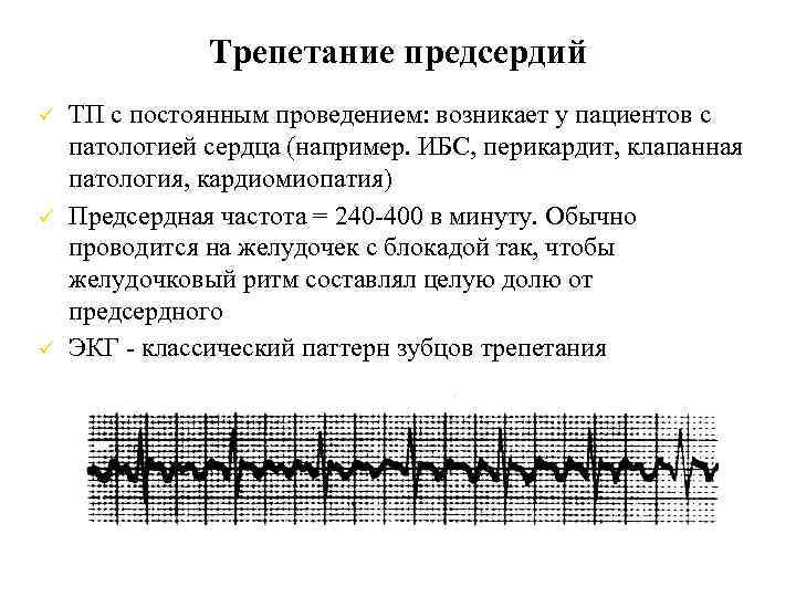 Трепетание предсердий ТП с постоянным проведением: возникает у пациентов с патологией сердца (например. ИБС,