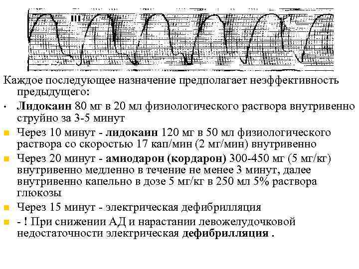 Каждое последующее назначение предполагает неэффективность предыдущего: • Лидокаин 80 мг в 20 мл физиологического