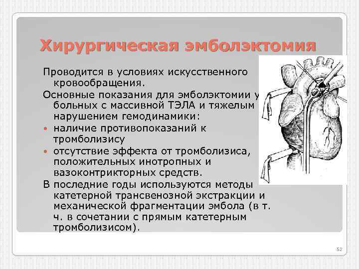 Хирургическая эмболэктомия Проводится в условиях искусственного кровообращения. Основные показания для эмболэктомии у больных с