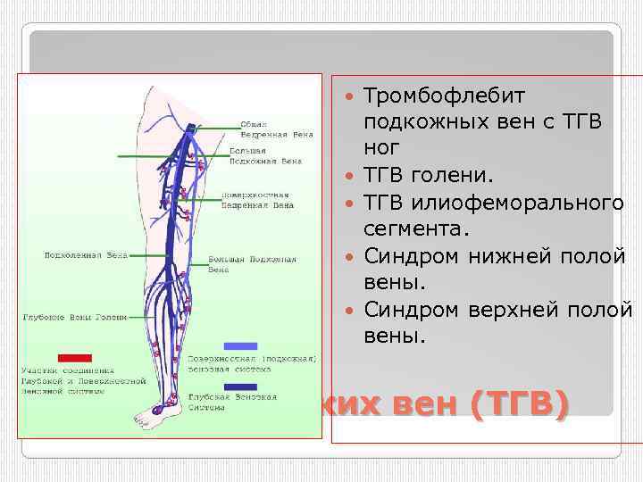  Тромбофлебит подкожных вен с ТГВ ног ТГВ голени. ТГВ илиофеморального сегмента. Синдром нижней