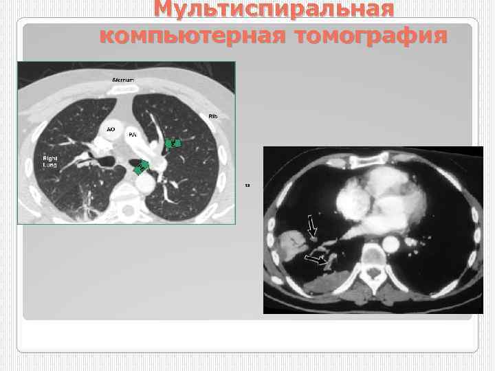 Мультиспиральная компьютерная томография 