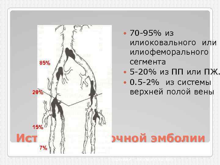 70 95% из илиоковального илиофеморального сегмента 5 20% из ПП или ПЖ. 0. 5