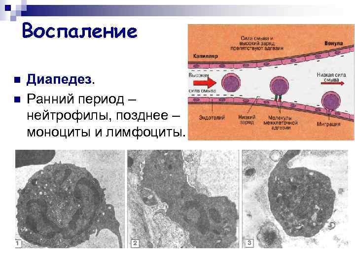 Воспаление n n Диапедез. Ранний период – нейтрофилы, позднее – моноциты и лимфоциты. 