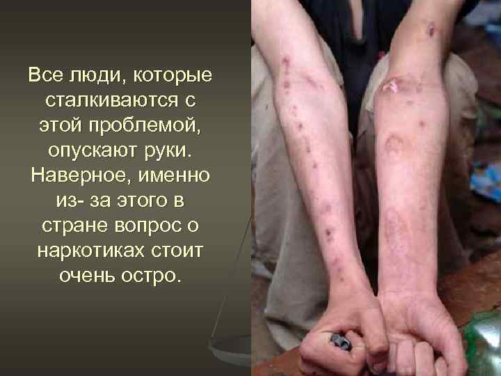 Все люди, которые сталкиваются с этой проблемой, опускают руки. Наверное, именно из- за этого