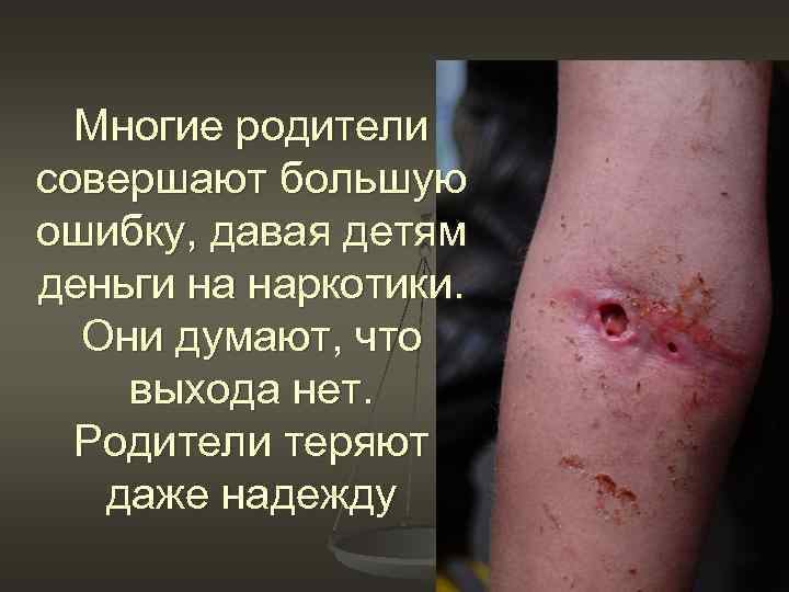 Многие родители совершают большую ошибку, давая детям деньги на наркотики. Они думают, что выхода