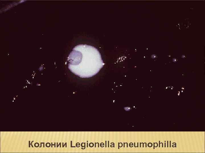 Колонии Legionella pneumophilla 