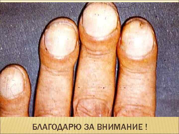 БЛАГОДАРЮ ЗА ВНИМАНИЕ ! 