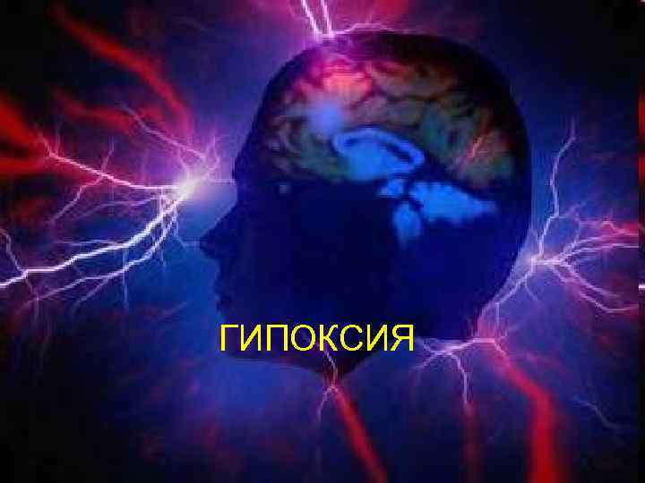 Гипоксия ГИПОКСИЯ 