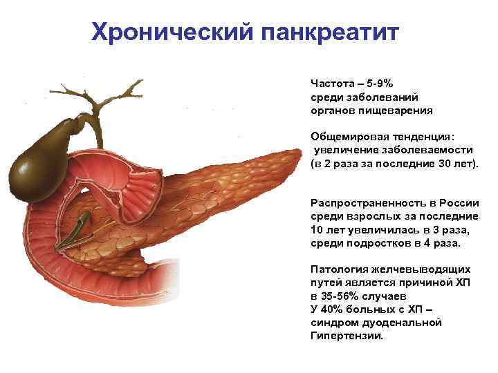 Хронический панкреатит Частота – 5 -9% среди заболеваний органов пищеварения Общемировая тенденция: увеличение заболеваемости