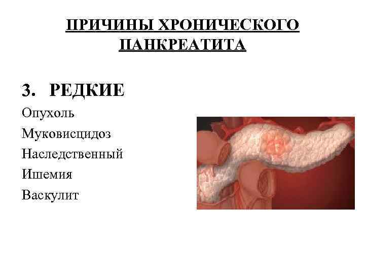 ПРИЧИНЫ ХРОНИЧЕСКОГО ПАНКРЕАТИТА 3. РЕДКИЕ Опухоль Муковисцидоз Наследственный Ишемия Васкулит 